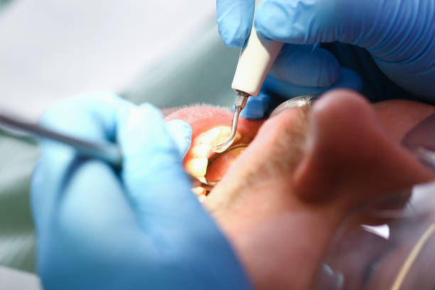 Best Emergency Dental Care for Broken or Chipped Teeth in Greenville, TX
